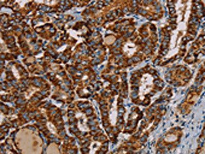 MRPL12 Antibody