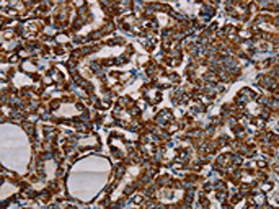 MRPL12 Antibody