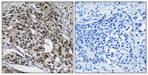 MRPL13 antibody