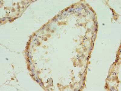 MRPL18 Antibody