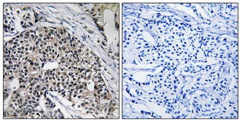 MRPL24 Antibody