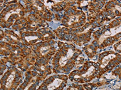 MRPL28 antibody