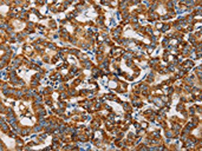 MRPL28 Antibody