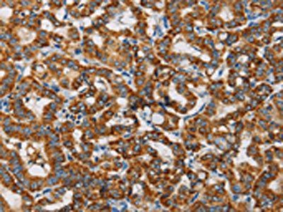 MRPL28 antibody