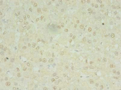 MRPL3 Antibody