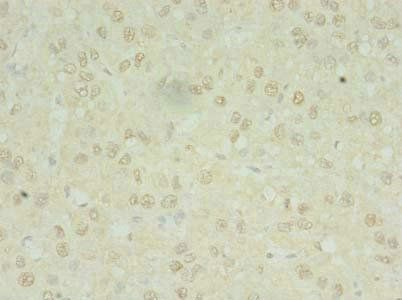 MRPL3 antibody