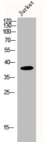 MRPL3 Antibody
