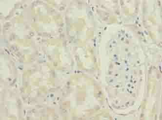 MRPL49 antibody