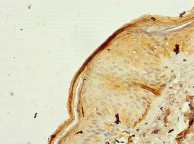 MRPL53 Antibody