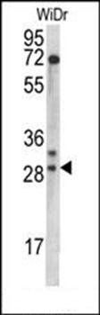 MRPL9 antibody