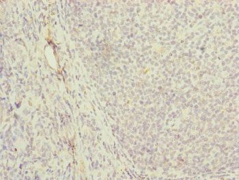 MRPS16 Antibody