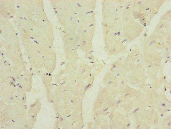MRPS16 Antibody