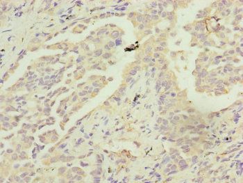 MRPS22 Antibody