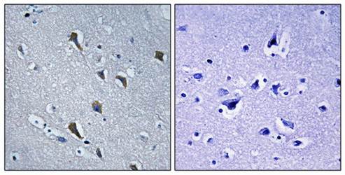 MRPS2 Antibody