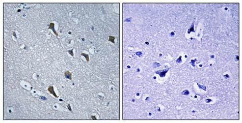 MRPS2 antibody