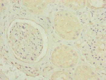 MRPS6 Antibody