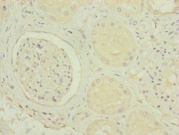 MRPS6 antibody