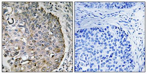MRRF Antibody