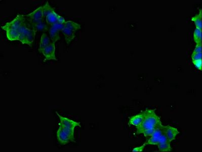 MRSA antibody