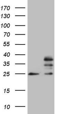MRTFA Antibody