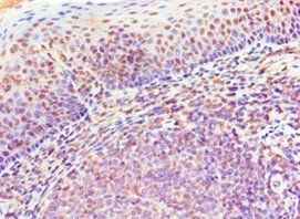 MS4A1 Antibody