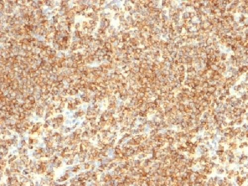 CD20 / MS4A1 (B-Cell Marker) Antibody
