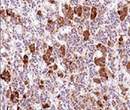 POMC Antibody