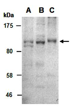 MSH2 (N) Antibody, Rabbit Polyclonal