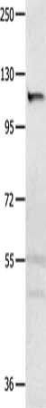 MSH3 antibody