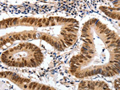 MSH3 Antibody