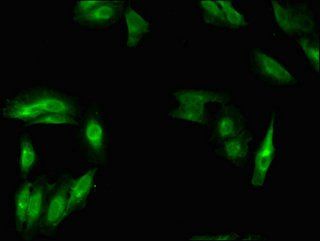 MSH4 antibody