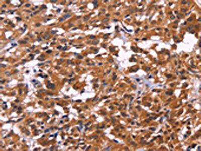 MSH4 Antibody