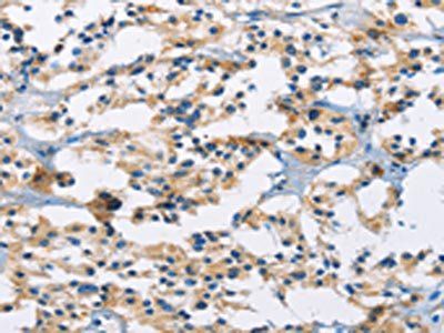 MSH5 Antibody