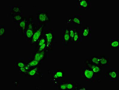 MSH6 antibody