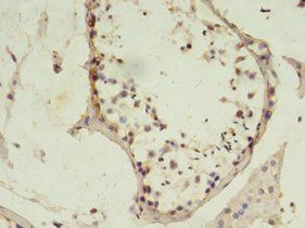 MSH6 Antibody