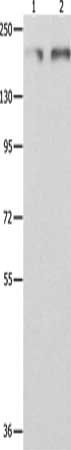 MSH6 antibody