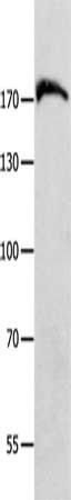 MSH6 Antibody