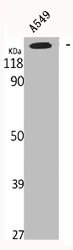 MSH6 Antibody