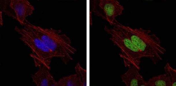 MSH6 Antibody