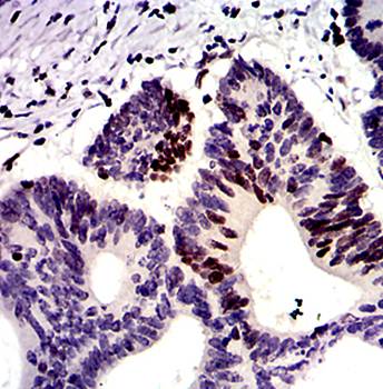 MSH6 Antibody