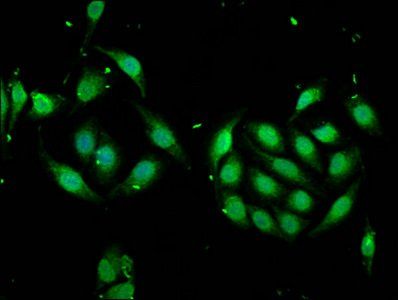MSI1 Antibody