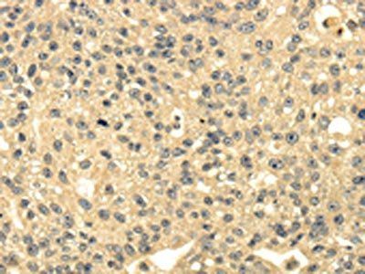 MSI1 Antibody