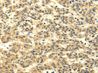 MSI1 Antibody
