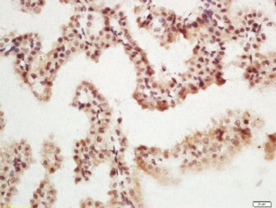 MSK1 (phospho-Ser376) antibody