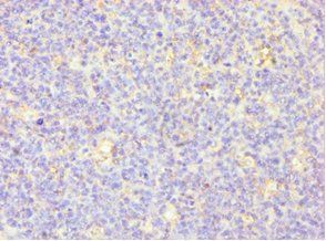 MSLN antibody