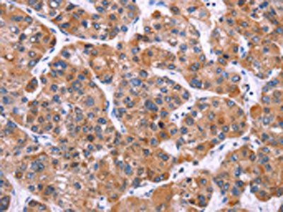 MSMO1 Antibody