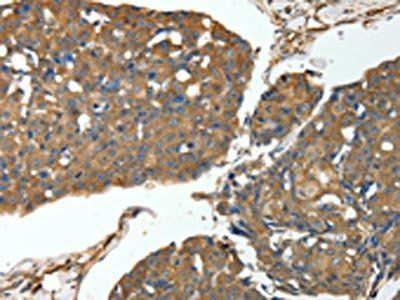 MSN Antibody