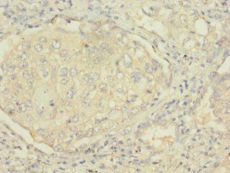 MSRB2 Antibody