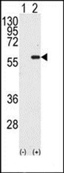 MST1 antibody