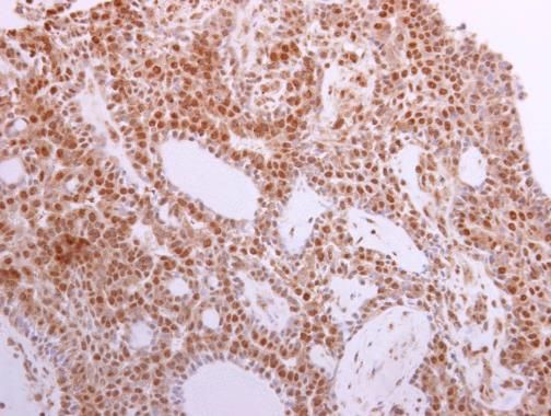 MST1 antibody
